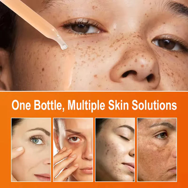 Vitamin C Serum – Whitening & Brightening for Smooth, Radiant Skin (30ml)